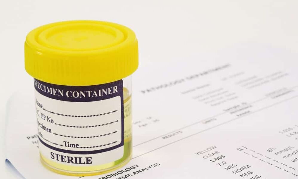 Antibiotikoak hartu aurretik gernu azterketa egin behar duzu